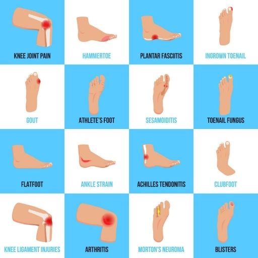 Various foot problems